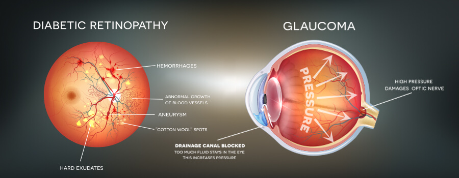 medical illustrations