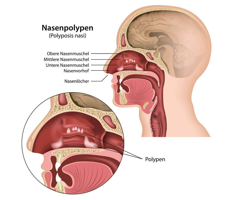 nasal illustration design