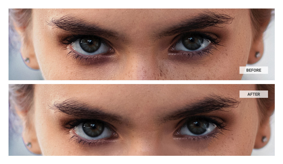 eye bag removal photoshop