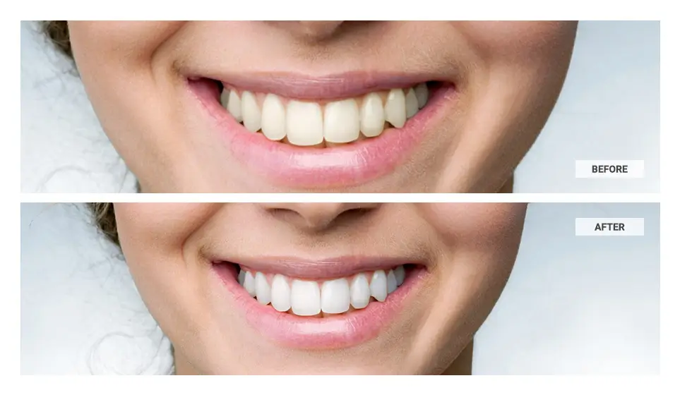 teeth whitening in photoshop